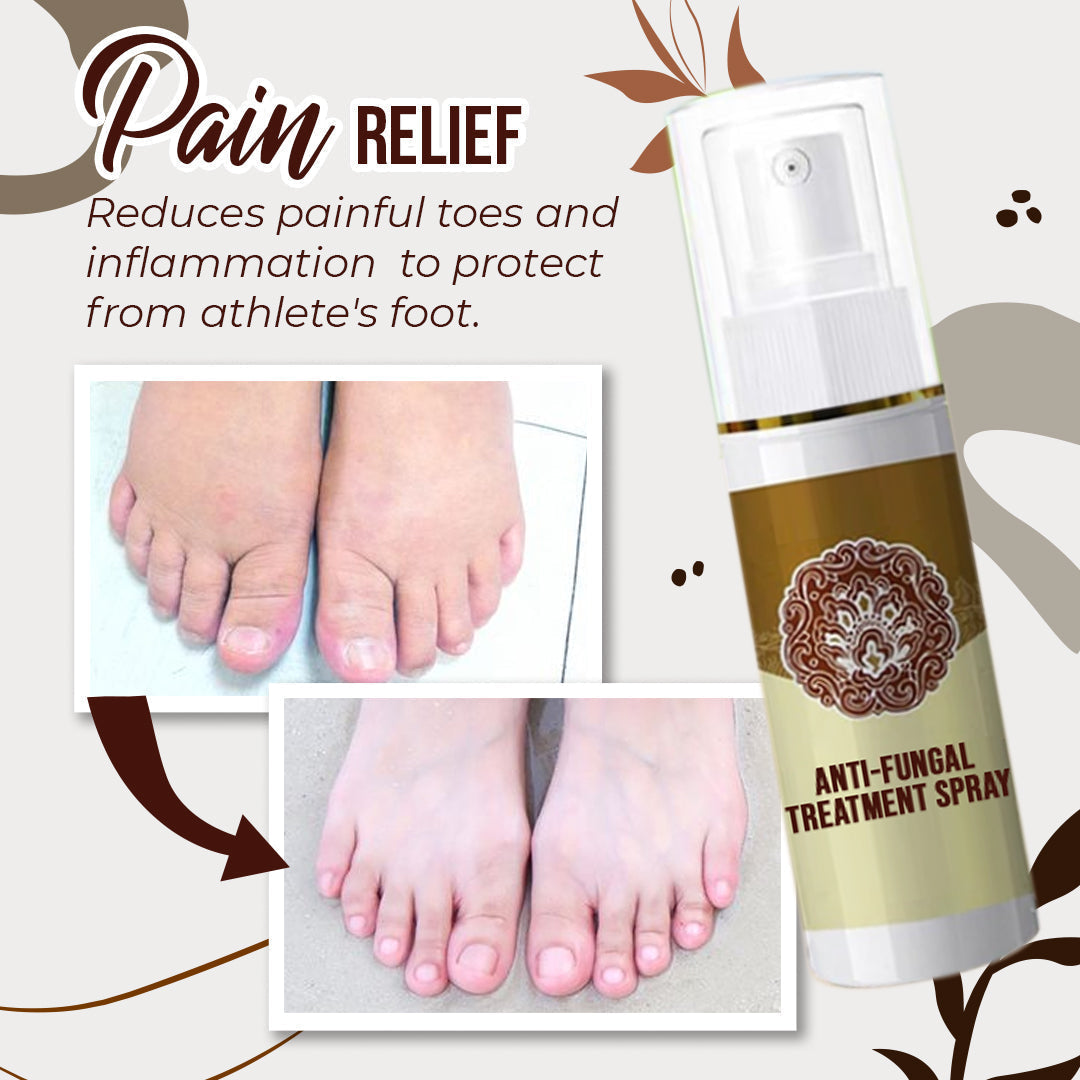 Hot Sale - Anti-Fungal Treatment Spray