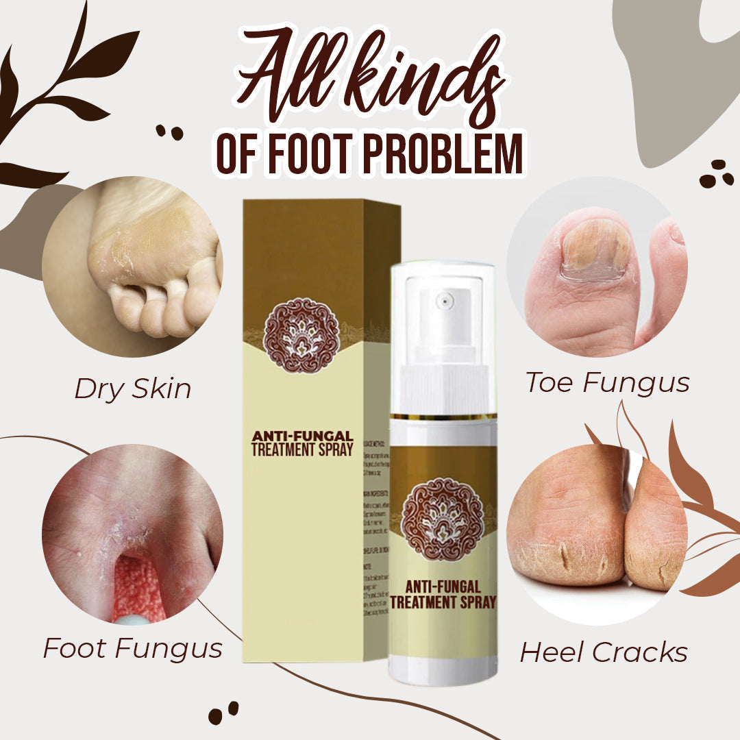 Hot Sale - Anti-Fungal Treatment Spray