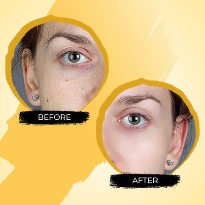 New Turmeric Dark Spot Corrector Serum