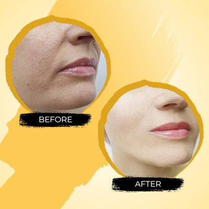 New Turmeric Dark Spot Corrector Serum