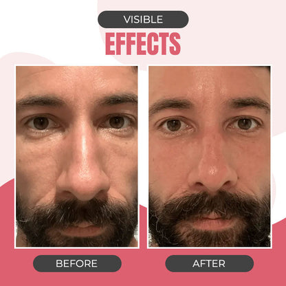 Advanced Skincare Wand with Red Light Therapy