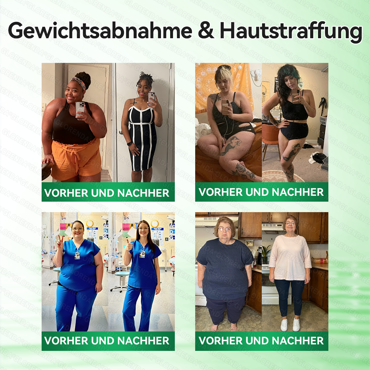 🇩🇪𝐎𝐟𝐟𝐢𝐳𝐢𝐞𝐥𝐥𝐞𝐫 𝐒𝐡𝐨𝐩 | 👩‍⚕️👩‍⚕️💃 𝑮𝑳𝑶𝐑𝐄𝐍𝐃𝘼®𝙈𝙤𝙧𝙞𝙣𝗴𝗮 · 𝗕𝗲𝗿𝗯𝗲𝗿𝒊𝒏 × 𝑵𝘼𝘿+ 10-𝙞𝙣-𝟏 𝐀𝐝𝐯𝐚𝗻𝗰𝗲𝗱 𝗡𝗮𝙣𝙤 𝙈𝙞𝙠𝙧𝐨𝐧𝐚𝐝𝐞𝐥-𝐏𝐚𝒕𝒄𝗵(𝐍𝐮𝐫 𝐞𝐢𝐧𝐦𝐚𝐥 𝐭ä𝐠𝐥𝐢𝐜𝐡, 𝐬𝐢𝐜𝐡𝐭𝐛𝐚𝐫𝐞 𝐕𝐞𝐫ä𝐧𝐝𝐞𝐫𝐮𝐧𝐠𝐞𝐧 𝐢𝐧 𝟕 𝐓𝐚𝐠𝐞𝐧)✅ 𝐅ü𝐫 𝐅𝐞𝐭𝐭𝐥𝐞𝐢𝐛𝐢𝐠𝐤𝐞𝐢𝐭, 𝐇𝐚𝐮𝐭𝐬𝐭𝐫𝐚𝐟𝐟𝐮𝐧𝐠, 𝐃𝐢𝐚𝐛𝐞𝐭𝐞𝐬, 𝐒𝐜𝐡𝐥𝐚𝐟𝐚𝐩𝐧𝐨𝐞, 𝐆𝐞𝐥𝐞𝐧𝐤𝐩𝐫𝐨𝐛𝐥𝐞𝐦𝐞 𝐮𝐧𝐝 𝐦𝐞𝐡𝐫!