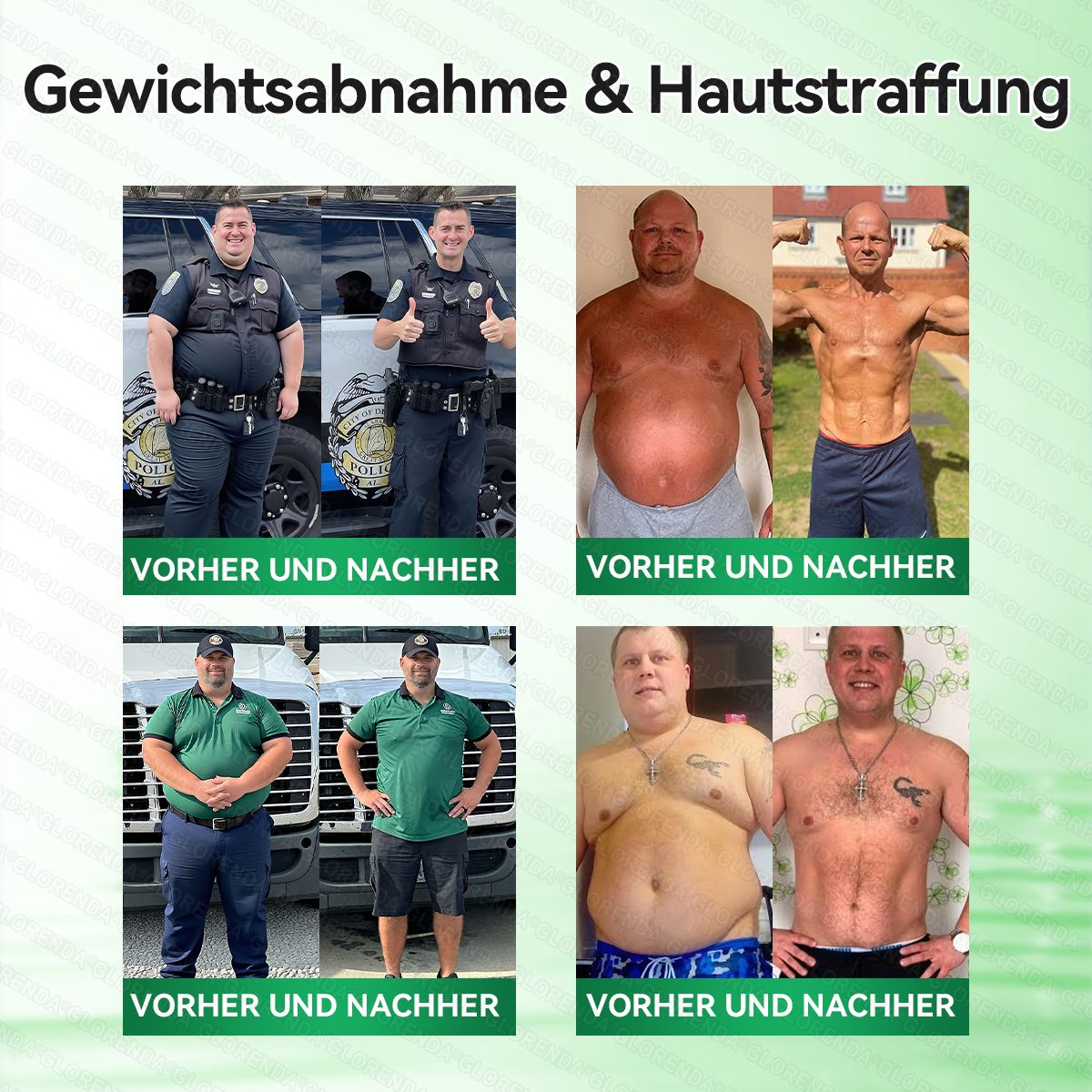 🇩🇪𝐎𝐟𝐟𝐢𝐳𝐢𝐞𝐥𝐥𝐞𝐫 𝐒𝐡𝐨𝐩 | 🩹👩‍⚕️ 𝑮𝑳𝑶𝐑𝐄𝐍𝐃𝘼®𝙈𝙤𝙧𝙞𝙣𝗴𝗮 · 𝗕𝗲𝗿𝗯𝗲𝗿𝒊𝒏 × 𝑵𝘼𝘿+ 10-𝙞𝙣-𝟏 𝐀𝐝𝐯𝐚𝗻𝗰𝗲𝗱 𝗡𝗮𝙣𝙤 𝙈𝙞𝙠𝙧𝐨𝐧𝐚𝐝𝐞𝐥-𝐏𝐚𝒕𝒄𝗵(𝐍𝐮𝐫 𝐞𝐢𝐧𝐦𝐚𝐥 𝐭ä𝐠𝐥𝐢𝐜𝐡, 𝐬𝐢𝐜𝐡𝐭𝐛𝐚𝐫𝐞 𝐕𝐞𝐫ä𝐧𝐝𝐞𝐫𝐮𝐧𝐠𝐞𝐧 𝐢𝐧 𝟕 𝐓𝐚𝐠𝐞𝐧)✅ 𝐅ü𝐫 𝐅𝐞𝐭𝐭𝐥𝐞𝐢𝐛𝐢𝐠𝐤𝐞𝐢𝐭, 𝐇𝐚𝐮𝐭𝐬𝐭𝐫𝐚𝐟𝐟𝐮𝐧𝐠, 𝐃𝐢𝐚𝐛𝐞𝐭𝐞𝐬, 𝐒𝐜𝐡𝐥𝐚𝐟𝐚𝐩𝐧𝐨𝐞, 𝐆𝐞𝐥𝐞𝐧𝐤𝐩𝐫𝐨𝐛𝐥𝐞𝐦𝐞 𝐮𝐧𝐝 𝐦𝐞𝐡𝐫!