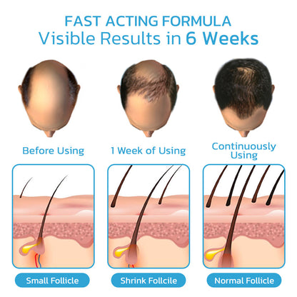 Hairmuch Hair Regrowth Ampoule Serum