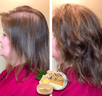 GingerPro Hair Regrowth Shampoo Bar