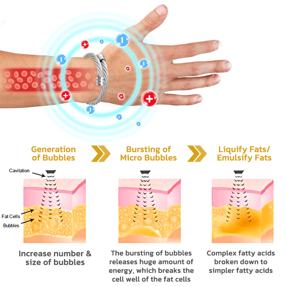 IONTitan Osimium Wristband