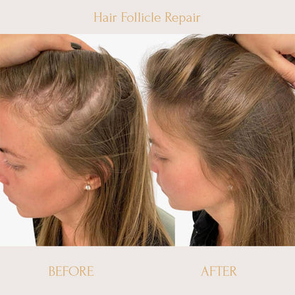 RegrowPlus Rice Water Serum