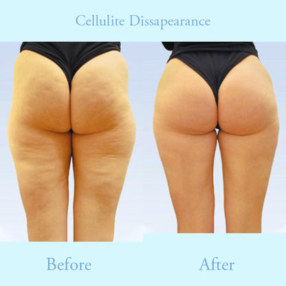 ProFirm Skin Firming Spray