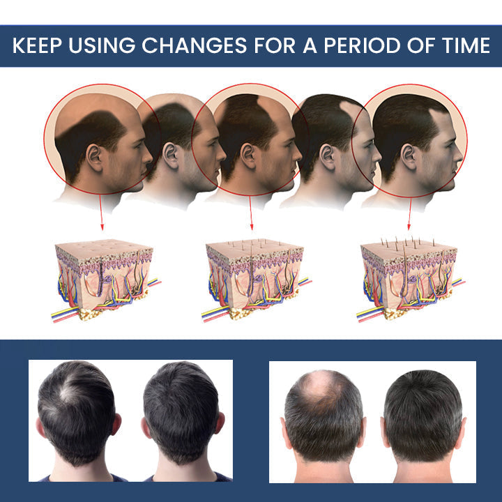 Hair Thickening Ginger Essence Spray