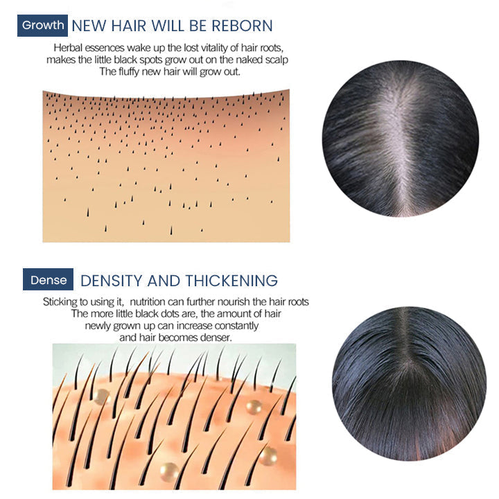 Hair Thickening Ginger Essence Spray