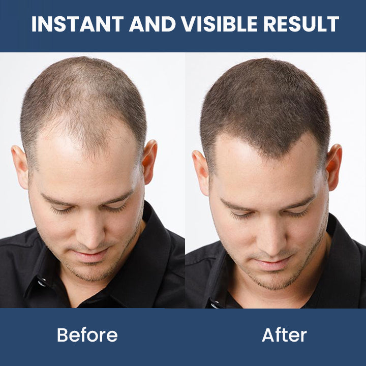 Hair Thickening Ginger Essence Spray