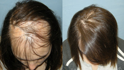 Hair Thickening Ginger Essence Spray