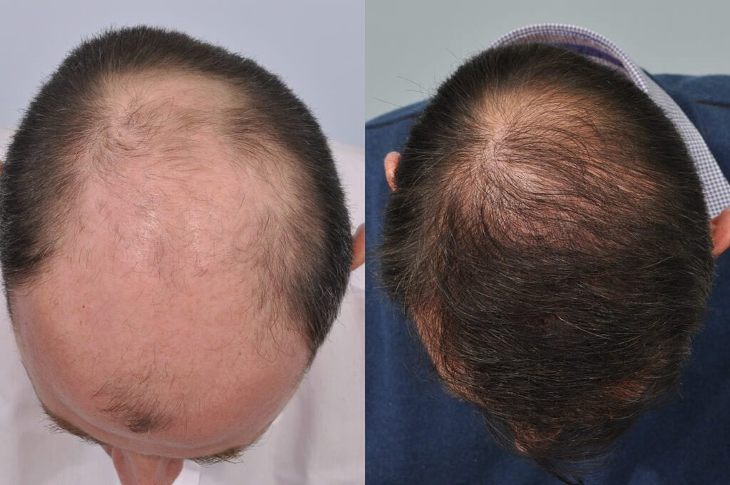 Hair Thickening Ginger Essence Spray