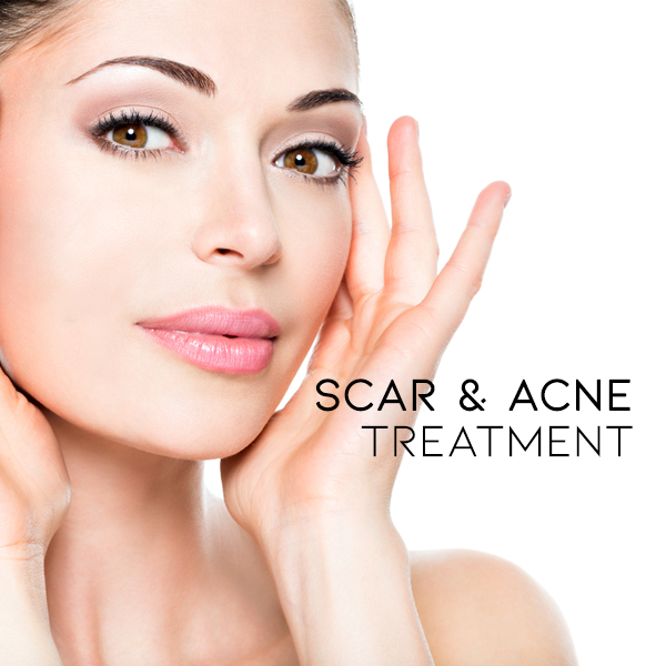 Scar & Acne Bump Removal Cream