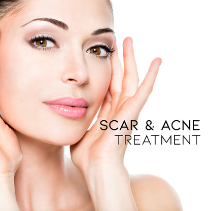 Scar & Acne Bump Removal Cream