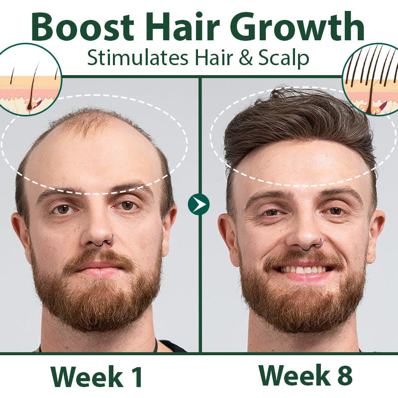 HairRegen RedGinseng Spray