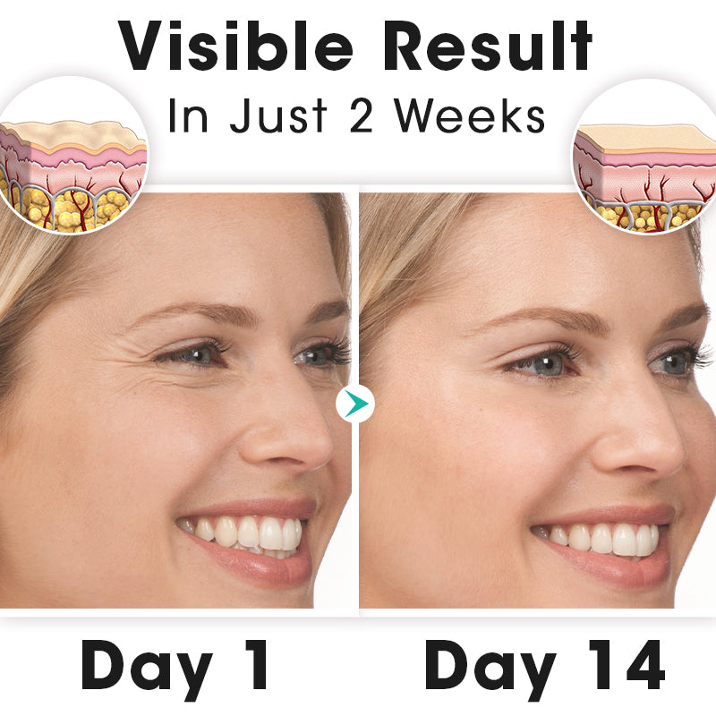ProFirm Korean Soluble Protein Thread