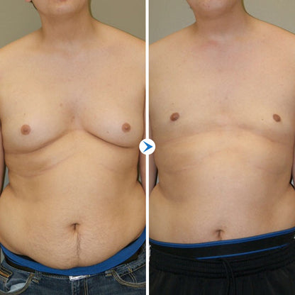 GynoOut Chest Tightening Spray
