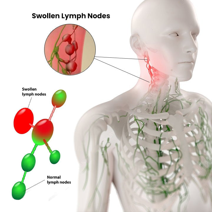Lymphatic Drainage Herbal Shower Gel