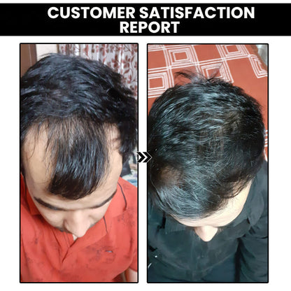 Shouga Kingu Hair Growth Oil