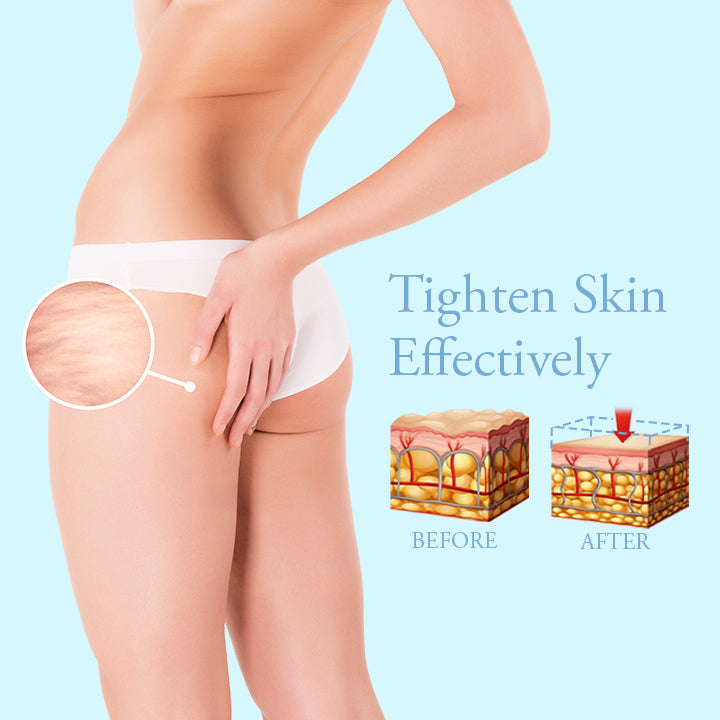 ProFirm Skin Firming Spray