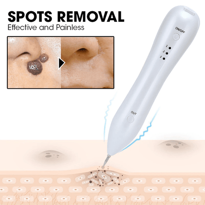 SpotAway Electric Derma Pen