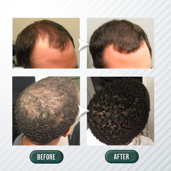 Instant Hair Regrowth Centella Scrub